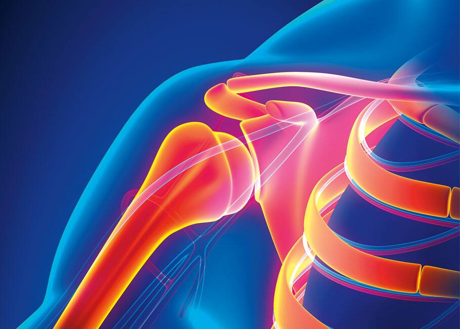 FYH Shoulder the pain Costco