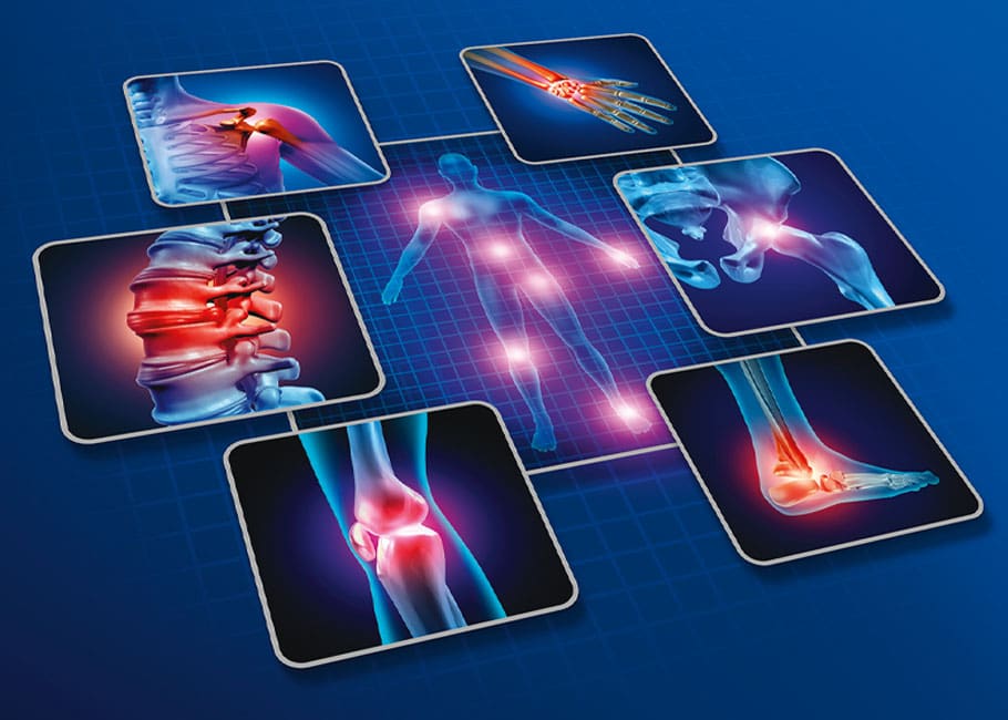 xrays of joints